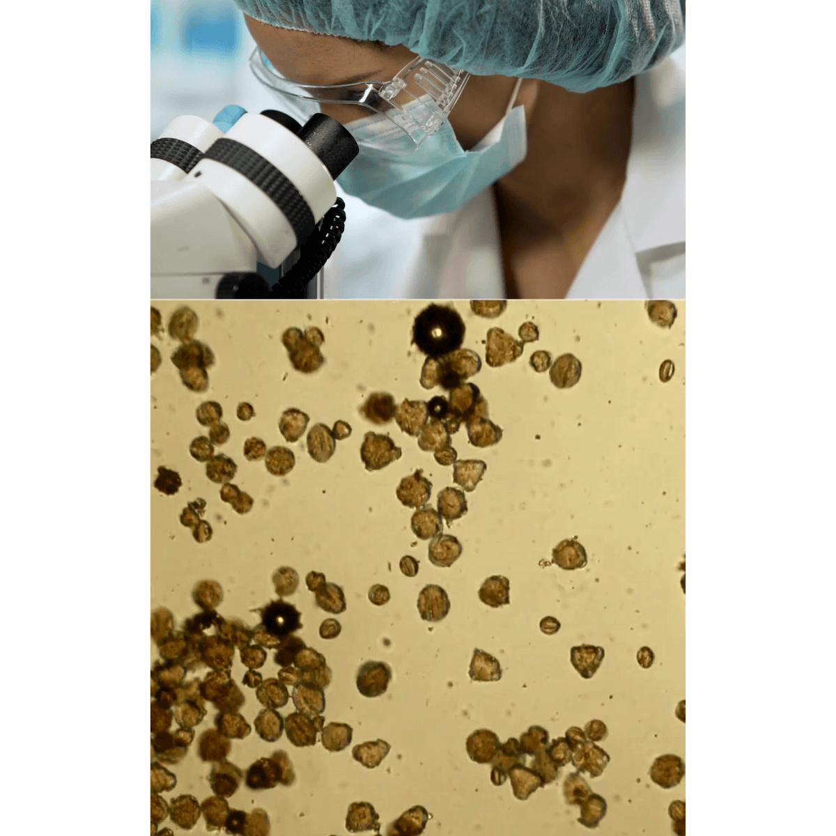 Análisis de polen por microscopio — historia botánica Ecoapi